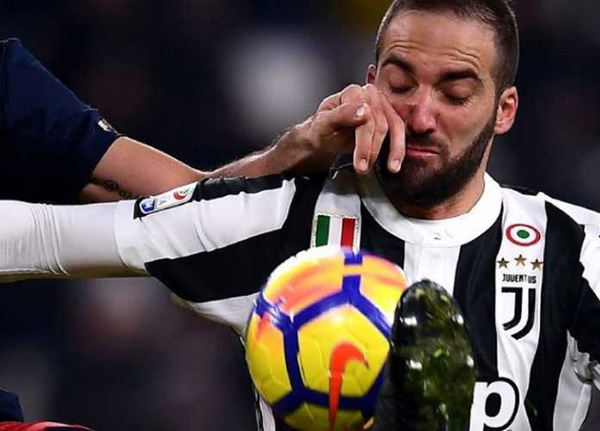 Tidak Ada Pemain Seperti Gonzalo Higuain Ungkap Medhi Benatia